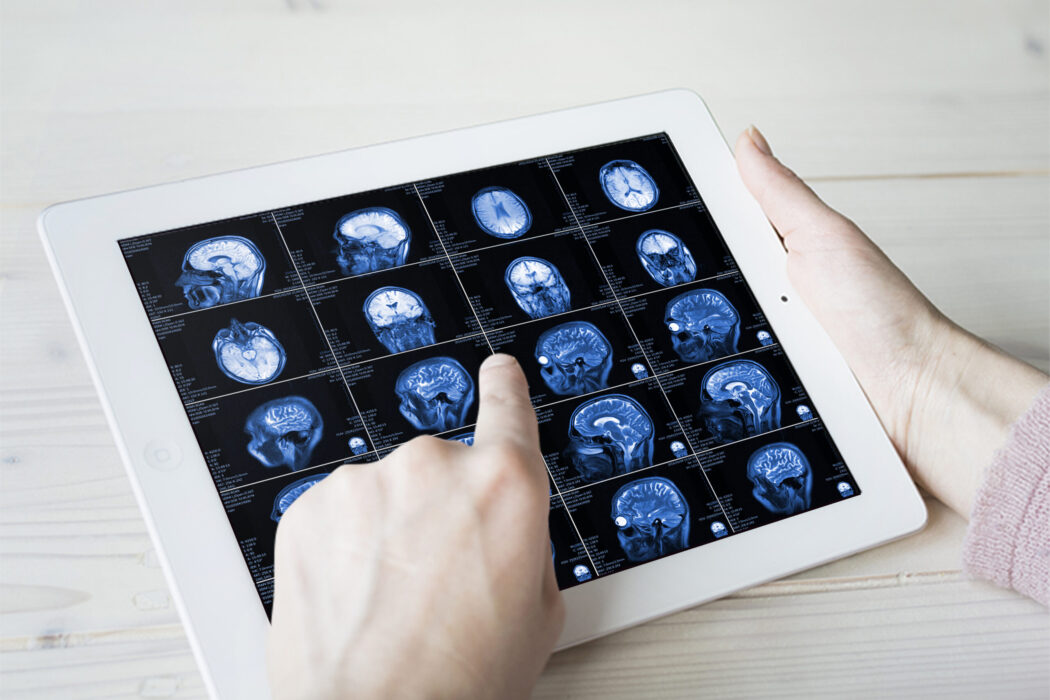 hands-hold-mri-scan-of-head-neck-and-brain-of-pat-2021-08-29-11-13-57-utc